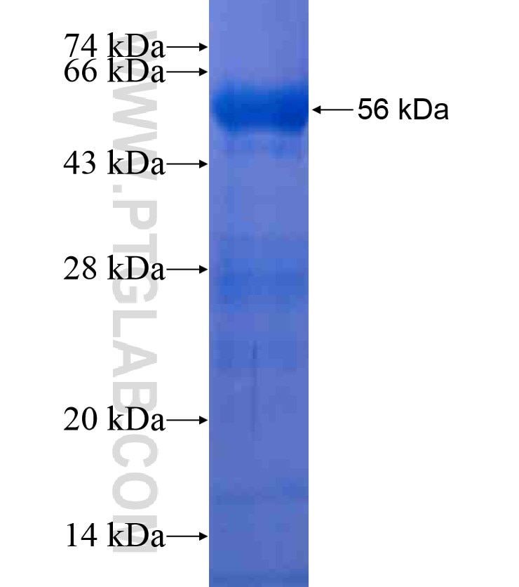 MEFV fusion protein Ag18386 SDS-PAGE