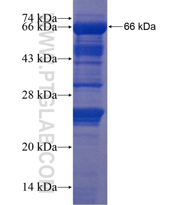 MEFV fusion protein Ag18000 SDS-PAGE