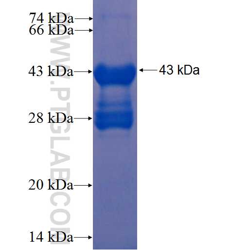 MEGF11 fusion protein Ag22955 SDS-PAGE MEGF11 fusion protein Ag22955 SDS-PAGE