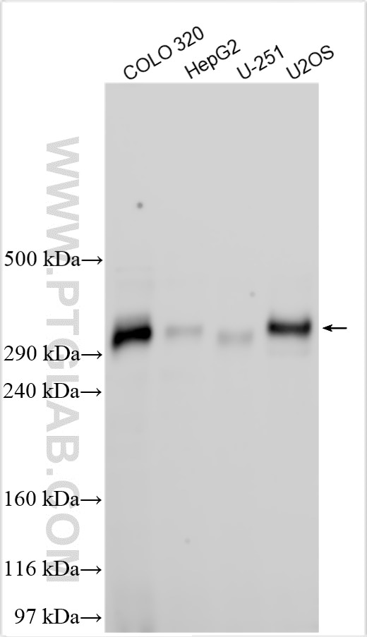 Western Blot (WB) analysis of various lysates using MEGF8 Polyclonal antibody (32300-1-AP)
