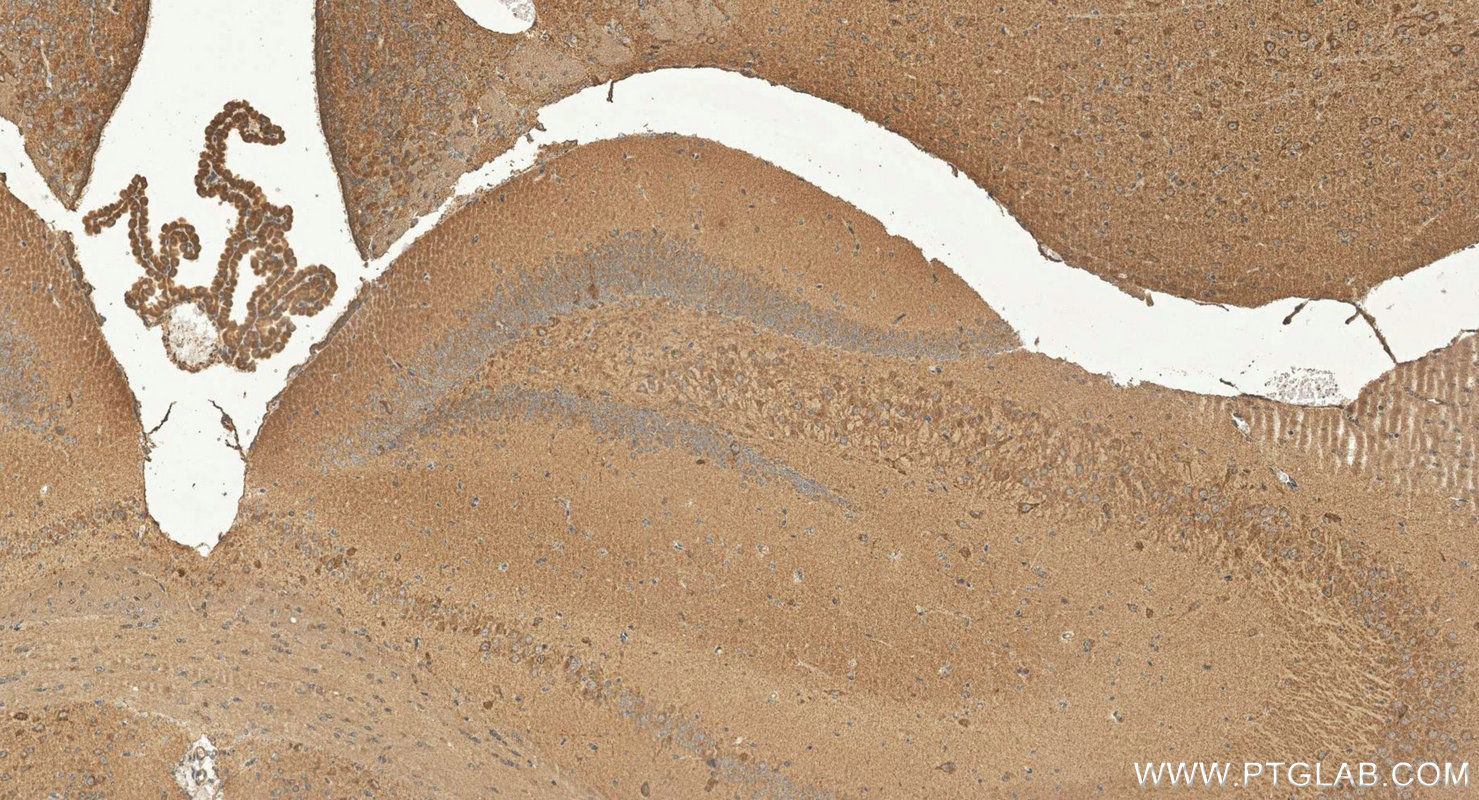 IHC staining of mouse brain using 29924-1-AP (same clone as 29924-1-PBS) Immunohistochemistry (IHC) staining of mouse brain tissue using MEGF9 Polyclonal antibody (29924-1-AP)