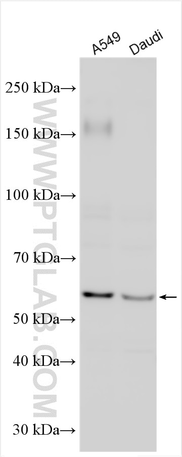 Western Blot (WB) analysis of various lysates using MEGF9 Polyclonal antibody (29924-1-AP)