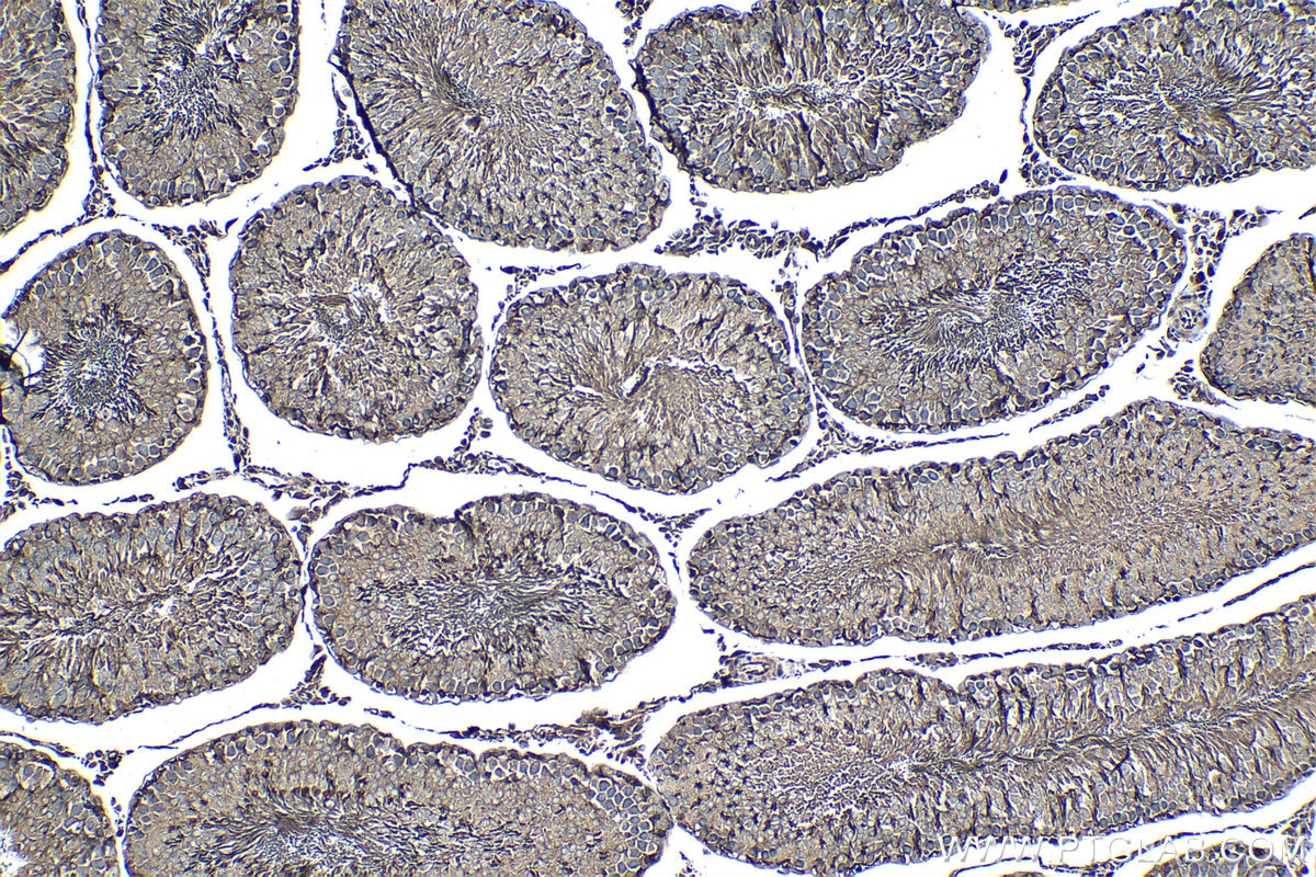 Immunohistochemistry (IHC) staining of rat testis tissue using MEI1 Polyclonal antibody (13456-1-AP)