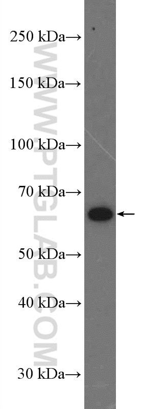 Western Blot (WB) analysis of mouse brain tissue using MEI1 Polyclonal antibody (13456-1-AP)