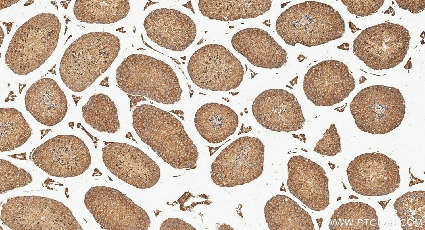 IHC staining of mouse testis using 29892-1-AP Immunohistochemistry (IHC) staining of mouse testis tissue using MEI4 Polyclonal antibody (29892-1-AP)