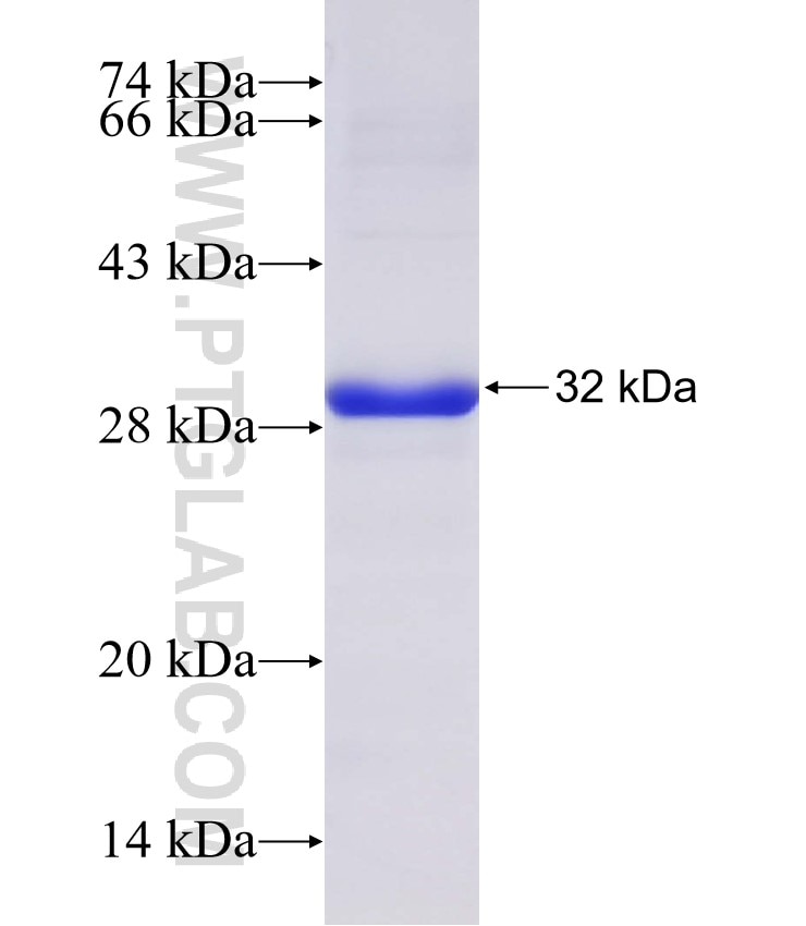 MEI4 fusion protein Ag31871 SDS-PAGE