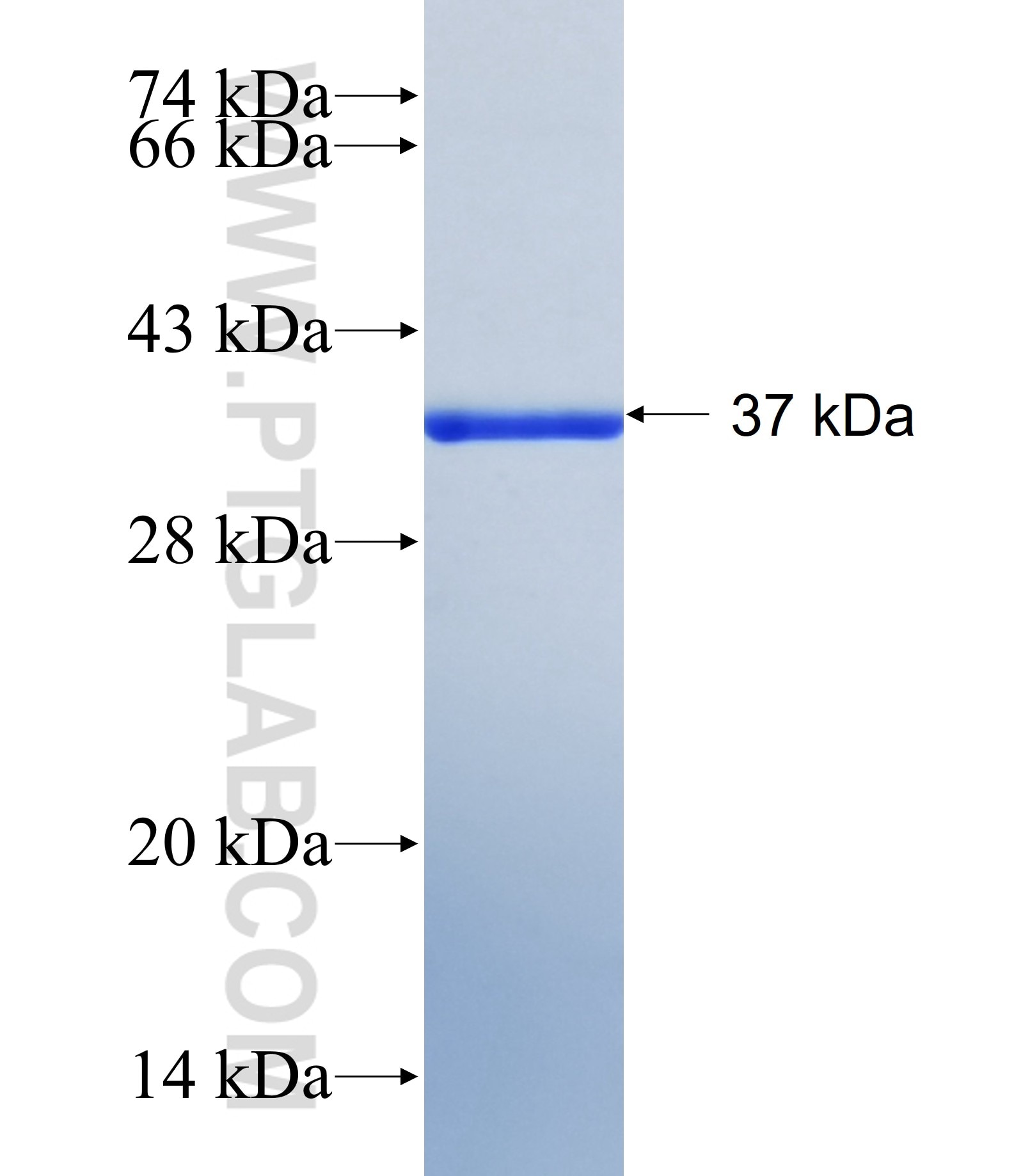 MEIG1 fusion protein Ag41104 SDS-PAGE MEIG1 fusion protein Ag41104 SDS-PAGE