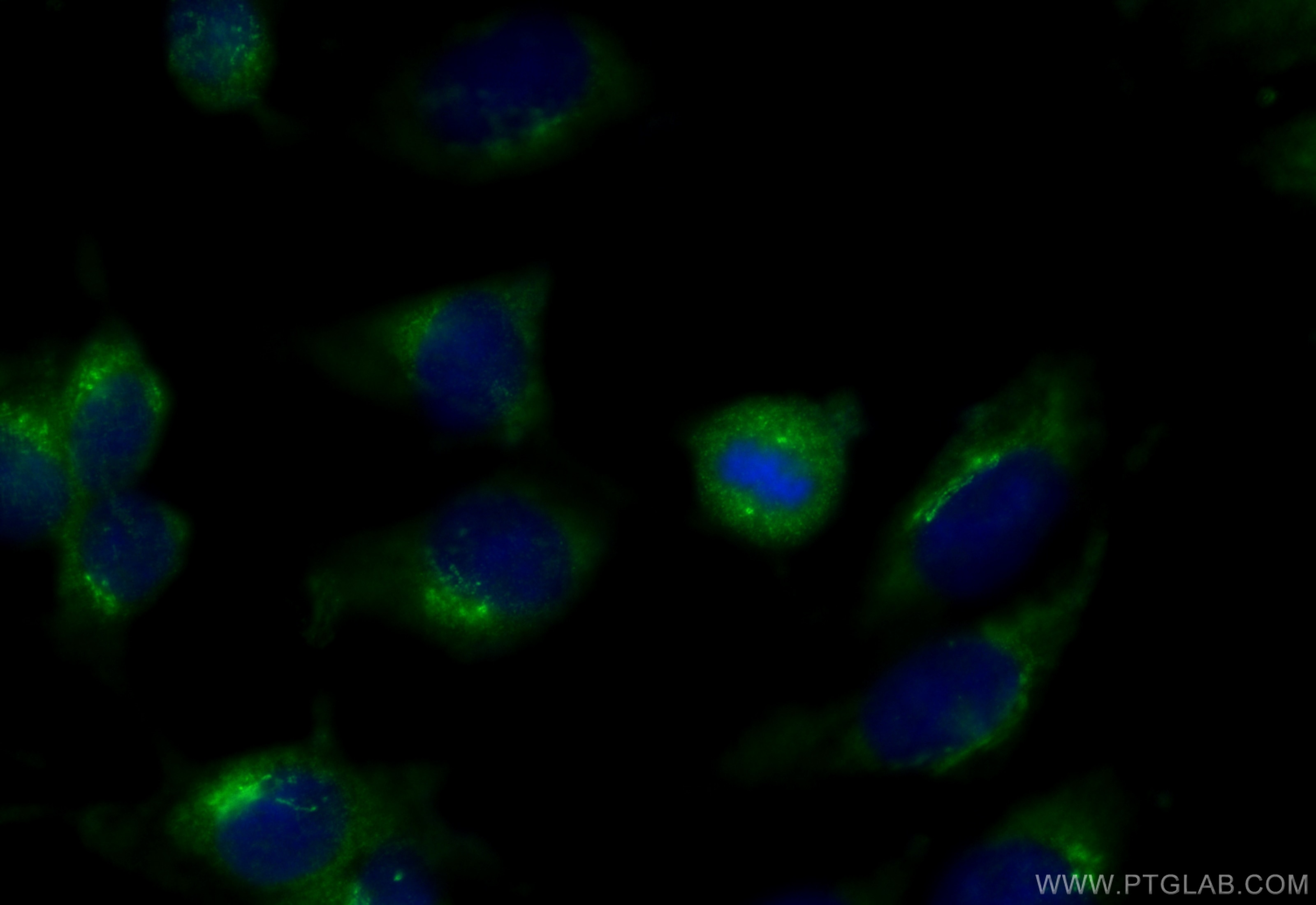 IF Staining of MDCK using 31759-1-AP (same clone as 31759-1-PBS) Immunofluorescence (IF) / fluorescent staining of MDCK cells using MEIKIN Polyclonal antibody (31759-1-AP)