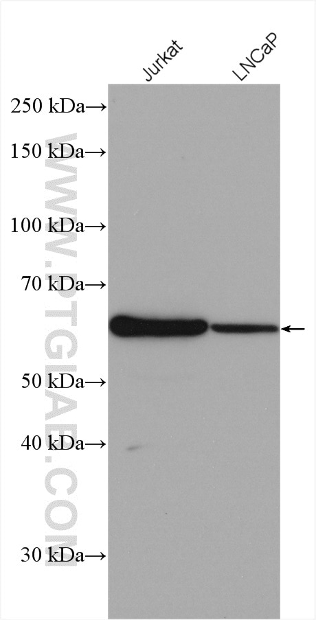 Western Blot (WB) analysis of various lysates using MEIS2 Polyclonal antibody (11550-1-AP)