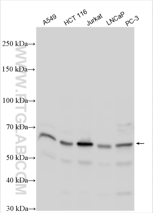 Western Blot (WB) analysis of various lysates using MEIS2 Polyclonal antibody (11550-1-AP)