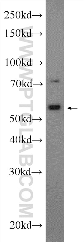Western Blot (WB) analysis of PC-3 cells using MEIS2 Polyclonal antibody (11550-1-AP)