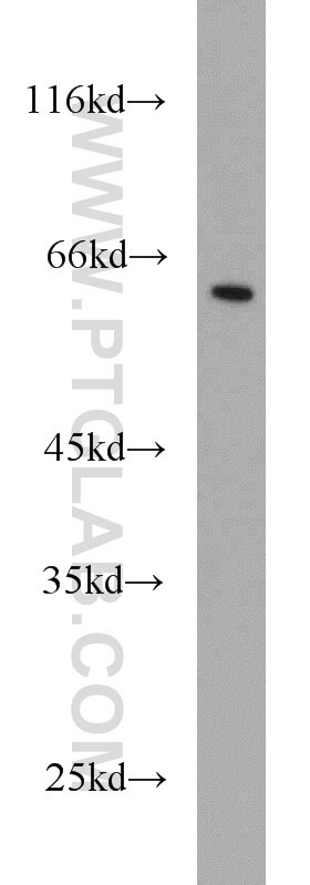 MEIS2 Polyclonal antibody