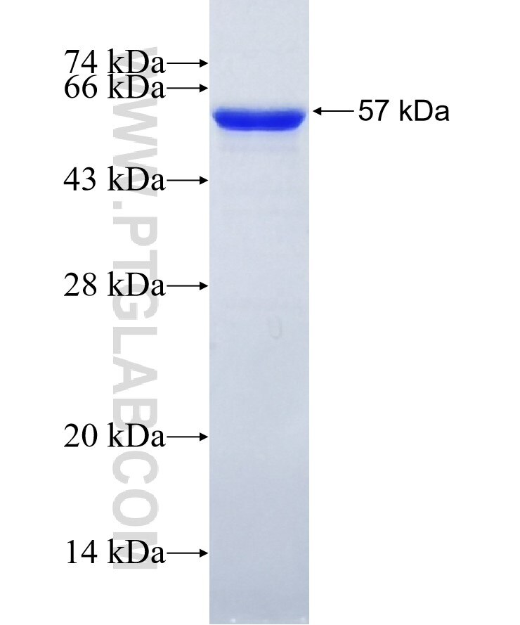MEIS2 fusion protein Ag27869 SDS-PAGE