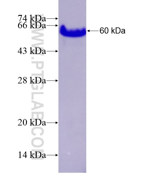 MEIS2 fusion protein Ag28975 SDS-PAGE