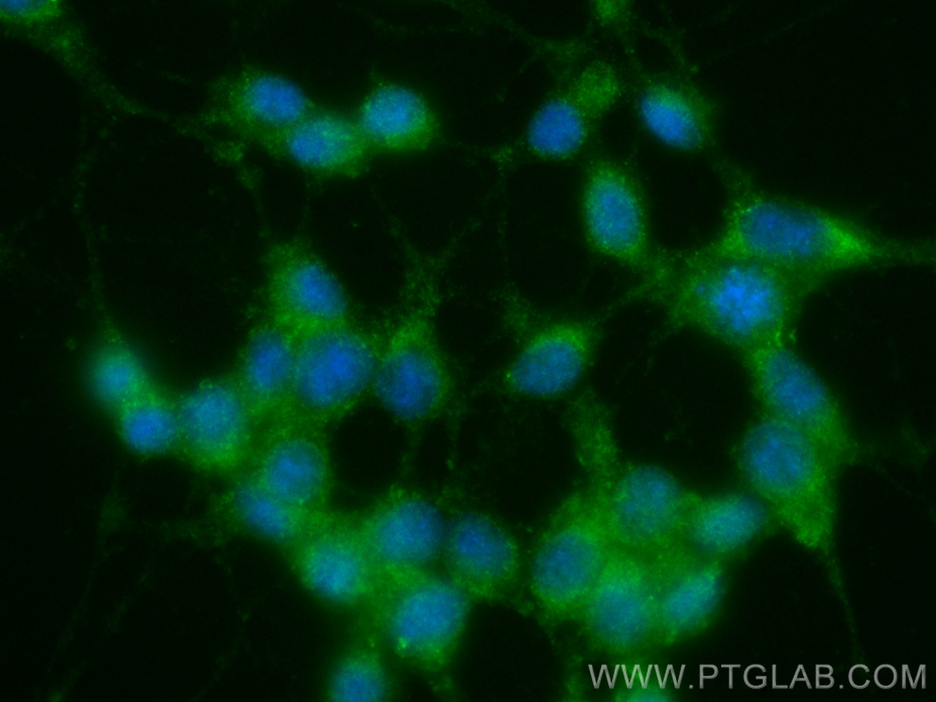 IF Staining of SH-SY5Y using CL488-11049