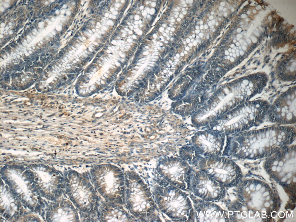 Immunohistochemistry (IHC) staining of human colon tissue using MEK1-Specific Polyclonal antibody (51080-1-AP)