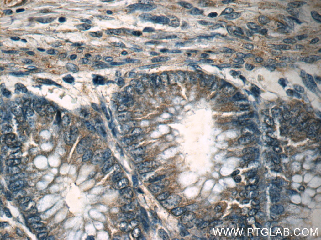 Immunohistochemistry (IHC) staining of human colon tissue using MEK1-Specific Polyclonal antibody (51080-1-AP)