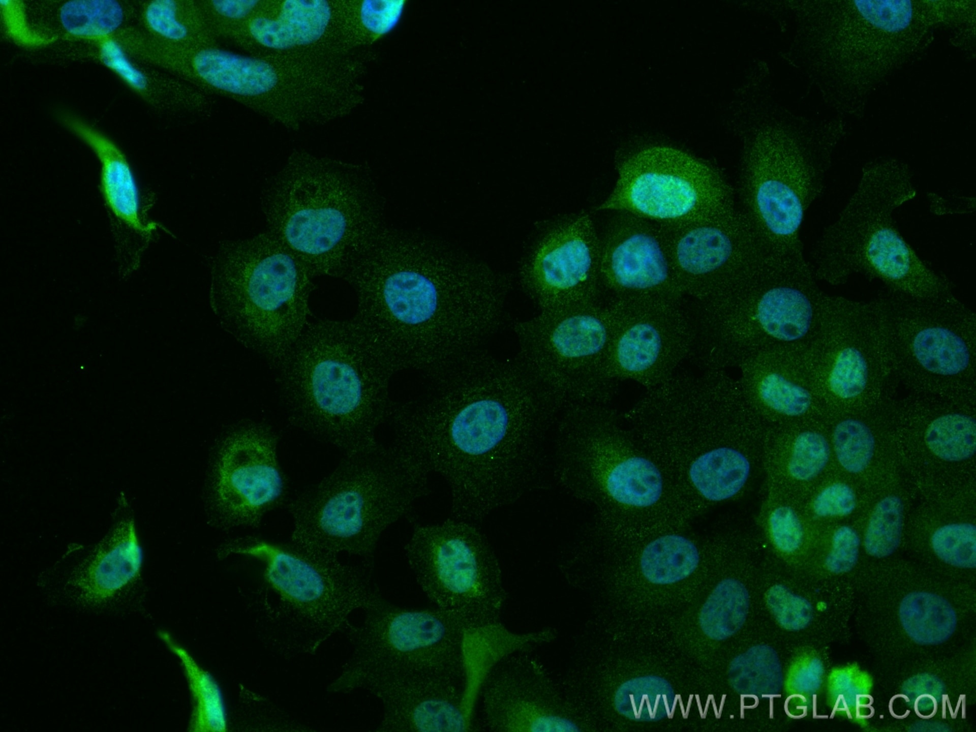 Immunofluorescence (IF) / fluorescent staining of A431 cells using CoraLite® Plus 488-conjugated MEK1 Monoclonal anti (CL488-67872)