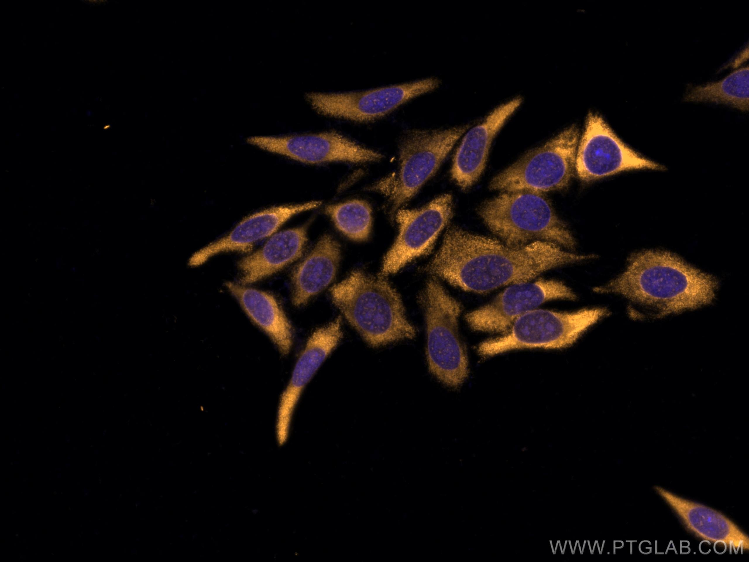 Immunofluorescence (IF) / fluorescent staining of HepG2 cells using CoraLite®555-conjugated MEK6 Polyclonal antibody (CL555-12745)