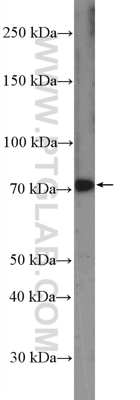 Western Blot (WB) analysis of mouse liver tissue using MEKK3 Polyclonal antibody (21072-1-AP)