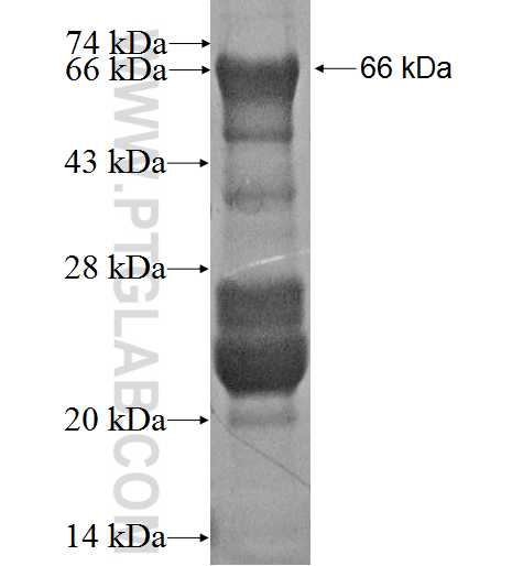 MEL18 fusion protein Ag2083 SDS-PAGE