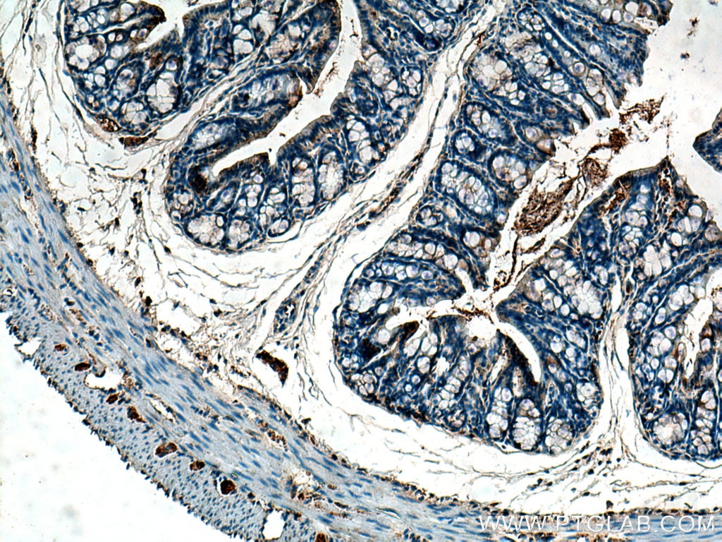 Immunohistochemistry (IHC) staining of mouse colon tissue using MELK Polyclonal antibody (11403-1-AP)