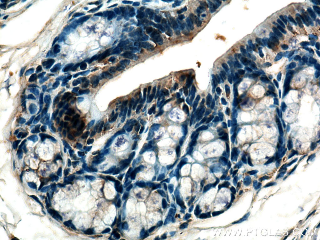 Immunohistochemistry (IHC) staining of mouse colon tissue using MELK Polyclonal antibody (11403-1-AP)