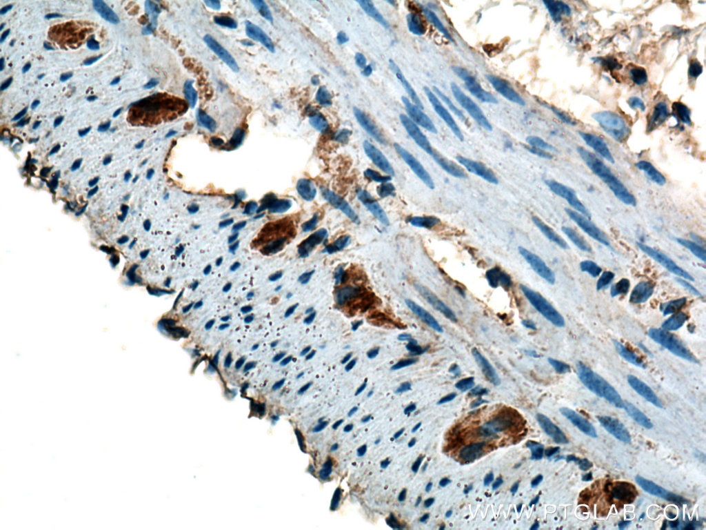 Immunohistochemistry (IHC) staining of mouse colon tissue using MELK Polyclonal antibody (11403-1-AP)