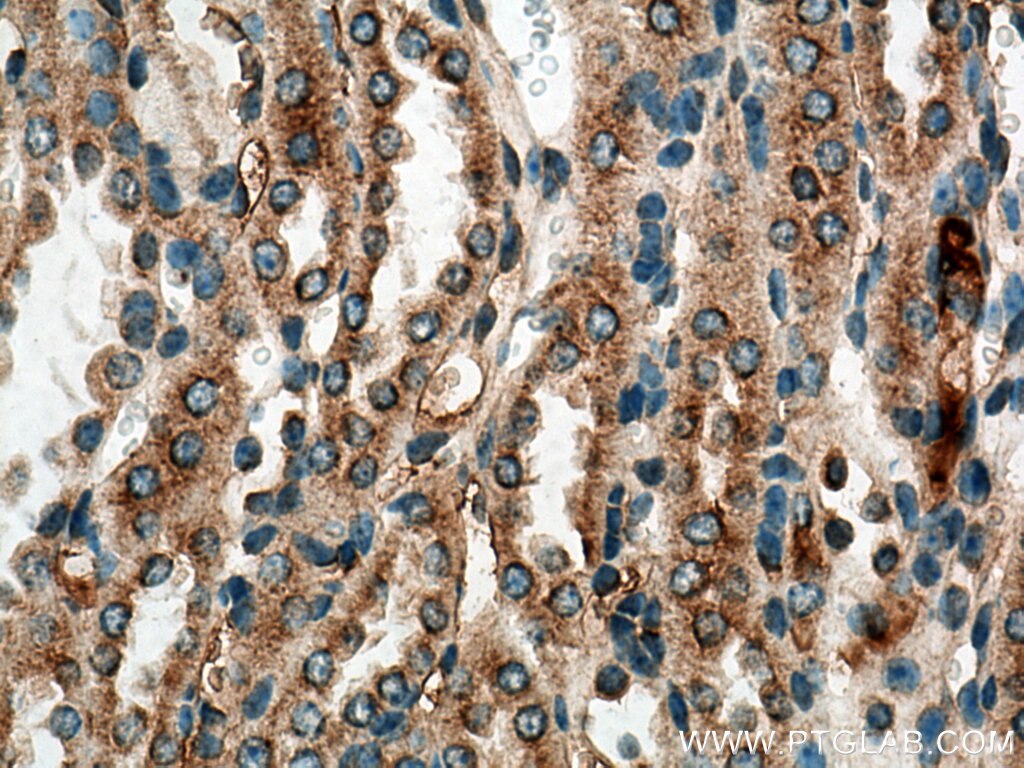 Immunohistochemistry (IHC) staining of mouse kidney tissue using MELK Polyclonal antibody (11403-1-AP)