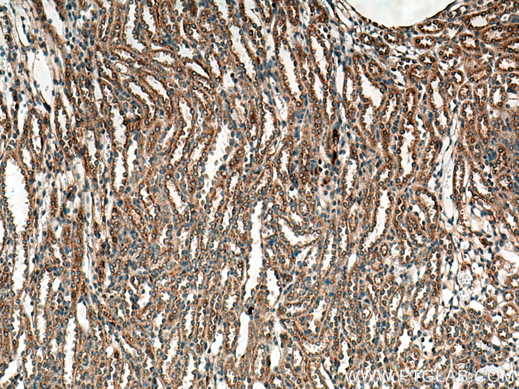 Immunohistochemistry (IHC) staining of mouse kidney tissue using MELK Polyclonal antibody (11403-1-AP)