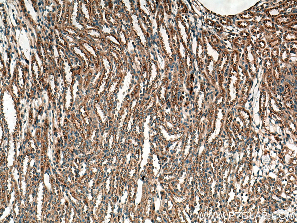 IHC staining of mouse kidney using 11403-1-AP