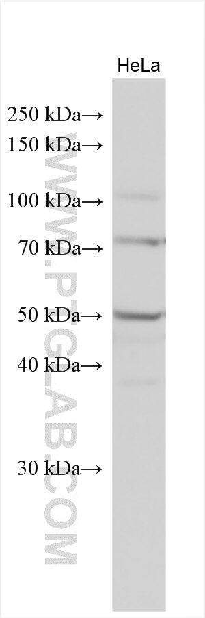 Western Blot (WB) analysis of various lysates using MELK Polyclonal antibody (11403-1-AP)