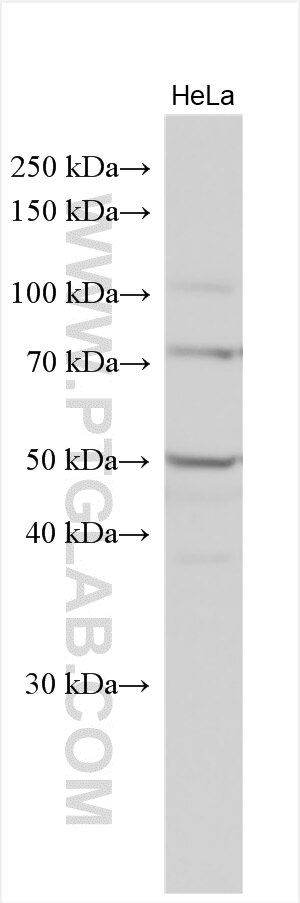 WB analysis using 11403-1-AP