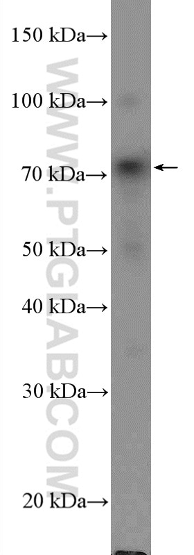 Western Blot (WB) analysis of Jurkat cells using MELK Polyclonal antibody (11403-1-AP)