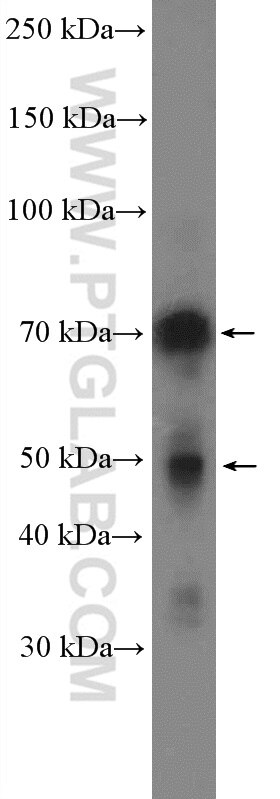 Western Blot (WB) analysis of K-562 cells using MELK Polyclonal antibody (11403-1-AP)