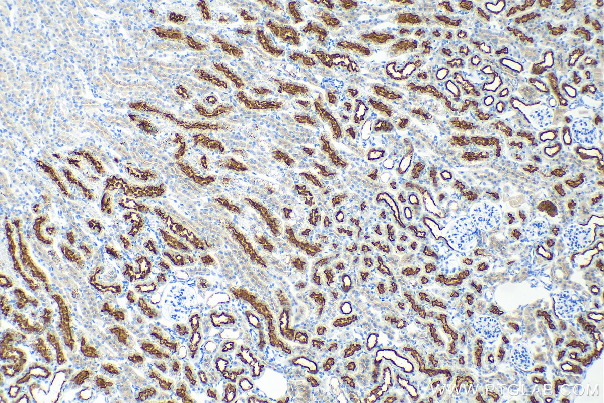 IHC staining of mouse kidney using 82893-2-RR
