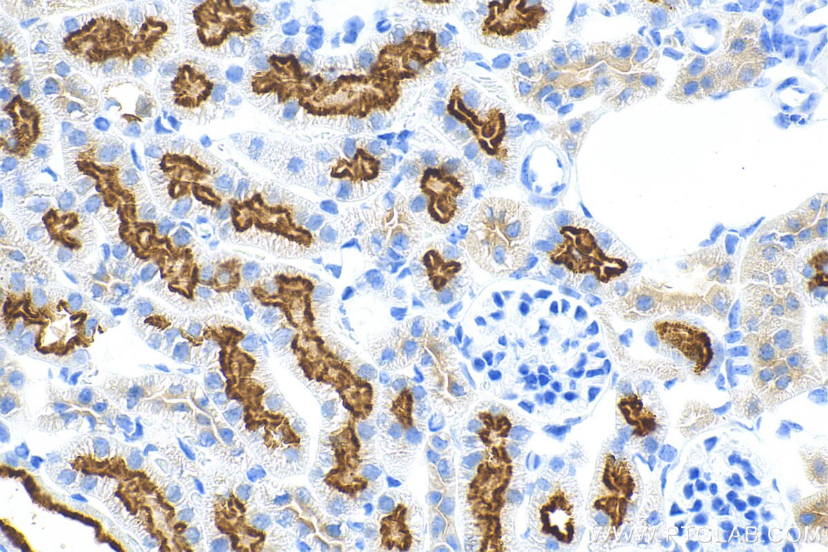 IHC staining of mouse kidney using 82893-2-RR