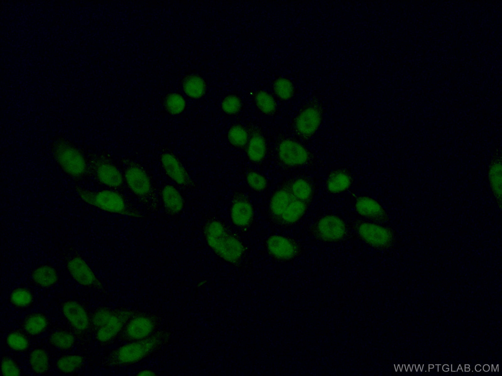 Immunofluorescence (IF) / fluorescent staining of HeLa cells using MEN1 Polyclonal antibody (15159-1-AP)