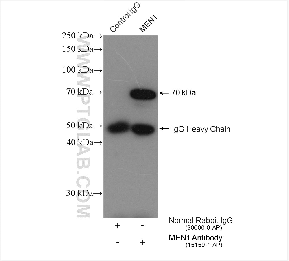 Immunoprecipitation (IP) experiment of HEK-293 cells using MEN1 Polyclonal antibody (15159-1-AP)
