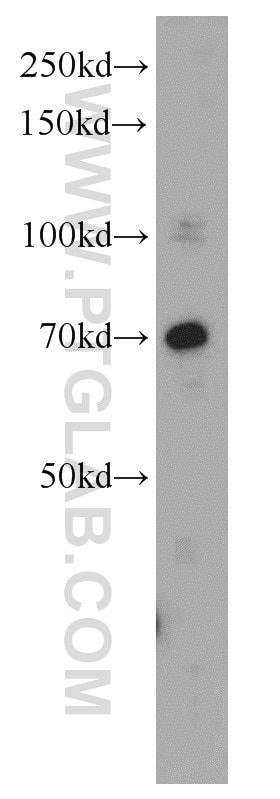 Western Blot (WB) analysis of HepG2 cells using MEN1 Polyclonal antibody (15159-1-AP)