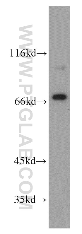 Western Blot (WB) analysis of Jurkat cells using MEN1 Polyclonal antibody (15159-1-AP)