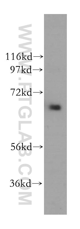 Western Blot (WB) analysis of HeLa cells using MEN1 Polyclonal antibody (15159-1-AP)