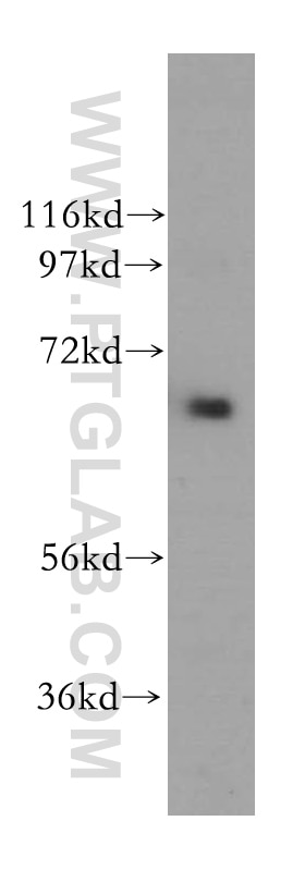 Western Blot (WB) analysis of HeLa cells using MEN1 Polyclonal antibody (15159-1-AP)