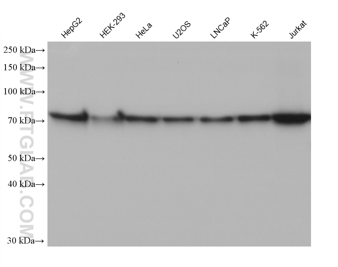 Western Blot (WB) analysis of various lysates using MEN1 Monoclonal antibody (68473-1-Ig)