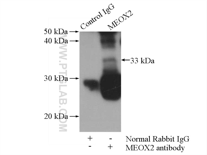 Immunoprecipitation (IP) experiment of human placenta tissue using MEOX2 Polyclonal antibody (12449-1-AP)