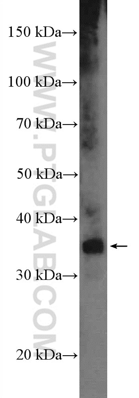 Western Blot (WB) analysis of human placenta tissue using MEOX2 Polyclonal antibody (12449-1-AP)