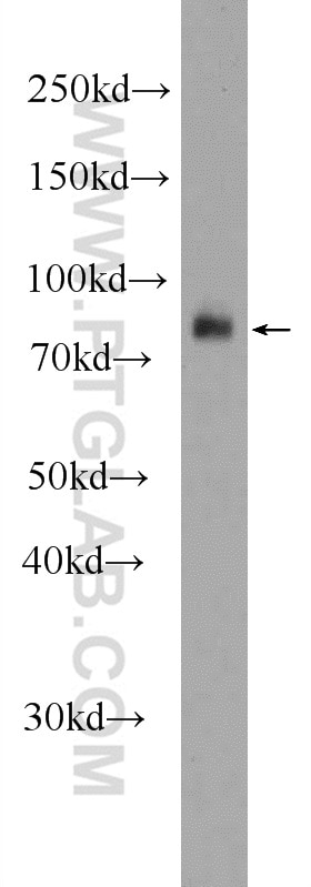 Western Blot (WB) analysis of mouse kidney tissue using MEP1A Polyclonal antibody (24640-1-AP)