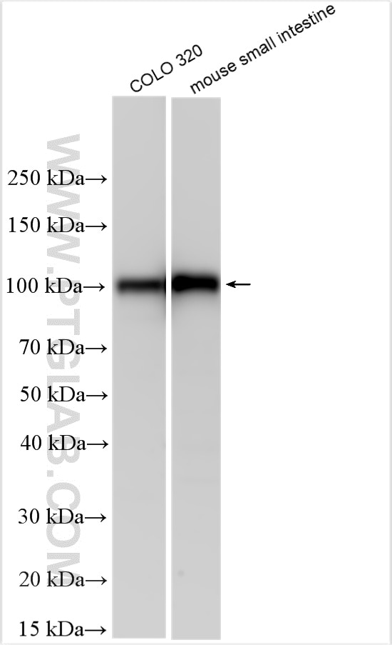 Western Blot (WB) analysis of various lysates using MEP1B Polyclonal antibody (32828-1-AP)