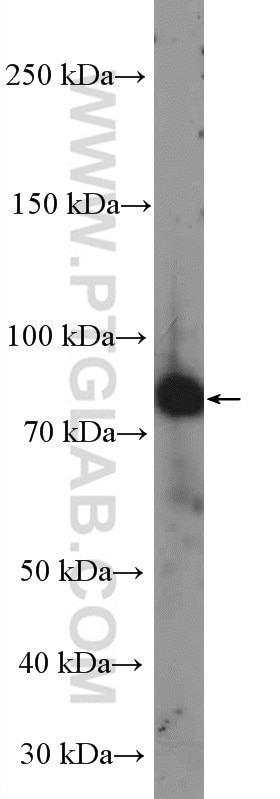 Western Blot (WB) analysis of HeLa cells using MEPCE Polyclonal antibody (11526-1-AP)