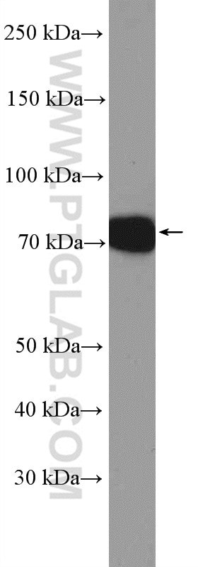 Western Blot (WB) analysis of K-562 cells using MEPCE Polyclonal antibody (11526-1-AP)